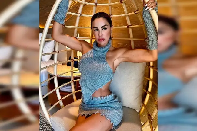 Crítican a Ninel Conde por recientes cirugías plásticas