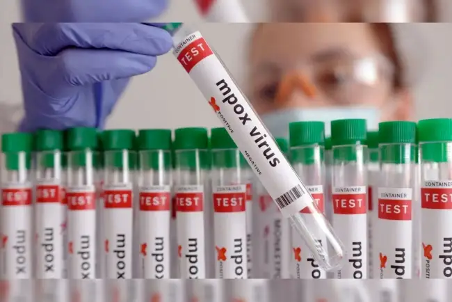 Lanza la OMS plan para detener propagación del Mpox