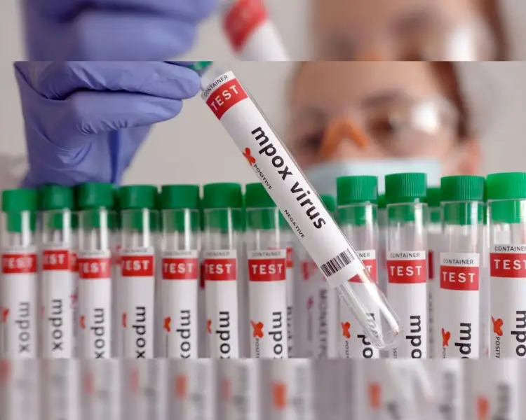 Lanza la OMS plan para detener propagación del Mpox