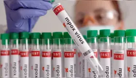 Lanza la OMS plan para detener propagación del Mpox