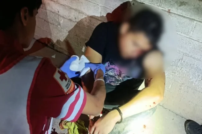 Joven resulta lesionado tras caer del puente peatonal de El Greco