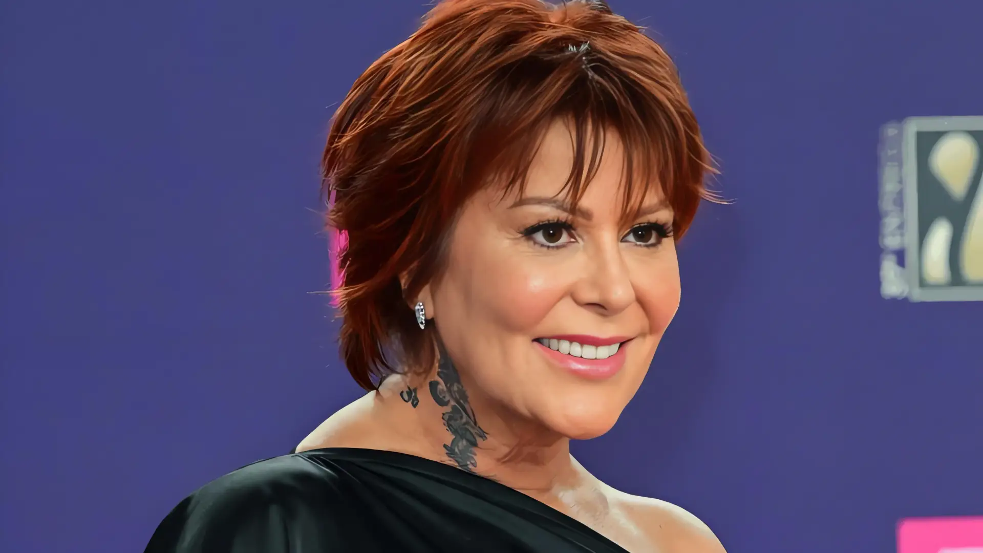 Alejandra Guzmán muestra radiografía tras cirugía de emergencia con implantes de titanio