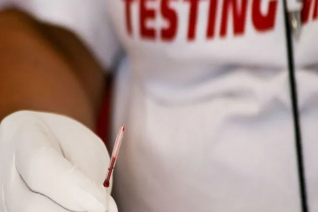 A casi 40 años de la pandemia del SIDA ¿por qué todavía no hay vacuna?