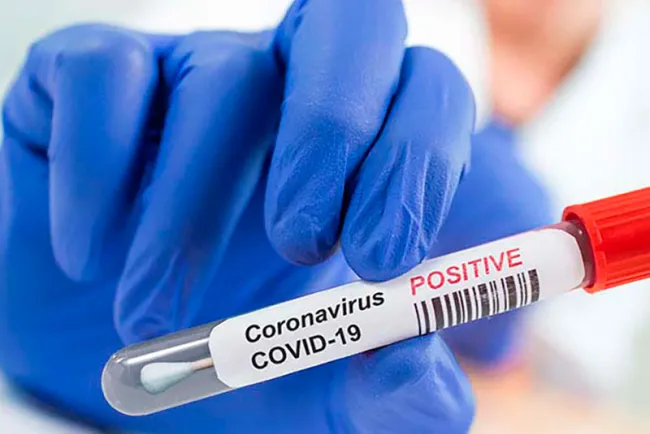 Registra Sonora 58 casos y una defunción por Covid-19