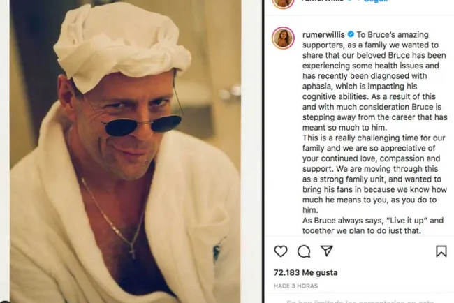 Bruce Willis se retira de la actuación tras ser diagnosticado con afasia