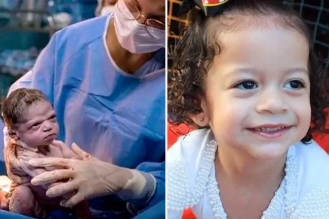 Bebé que se hizo viral por gesto de enojo, así luce ahora