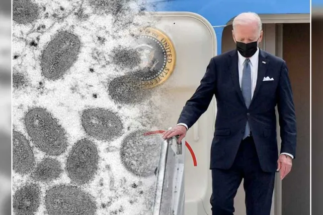 Advierte Biden que viruela del mono debe preocupar al mundo