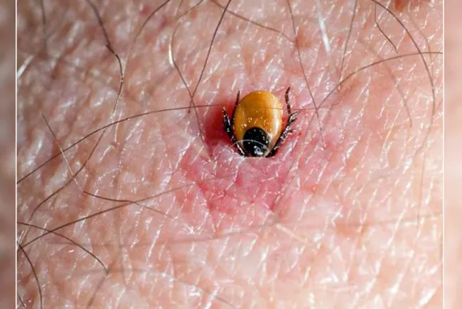 Alertan sobre presencia de garrapatas en patios
