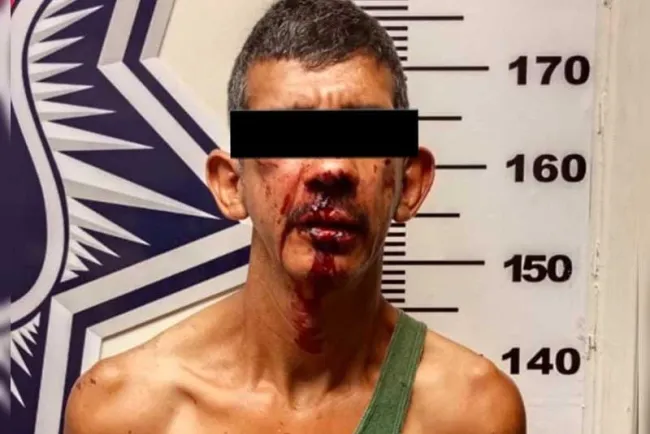 Agrede hombre a menor con hacha y piedras