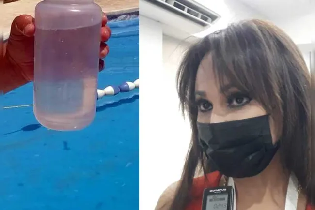 Detectan ‘amiba de vida libre’ en albercas públicas