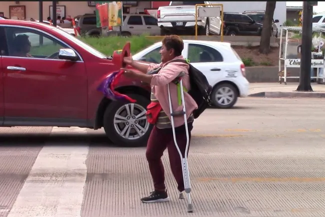 La falta de una pierna no le impide ser feliz