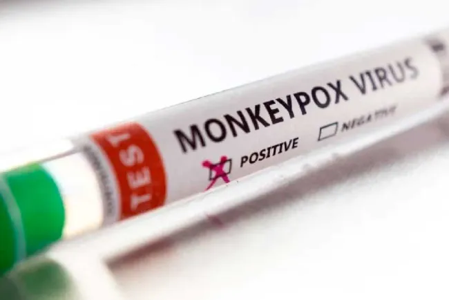 Modifica la OMS nombre de viruela del mono; ahora se llama 'mpox'