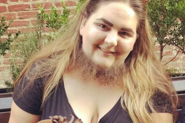 “Lucha” mujer contra estándares de belleza, se deja la barba