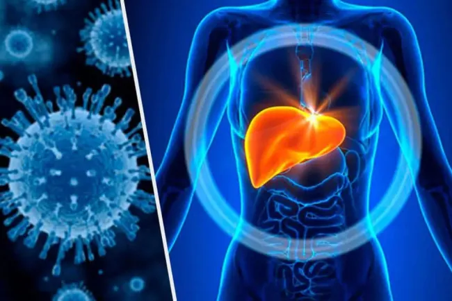 ¿Cómo puedes prevenir la hepatitis?