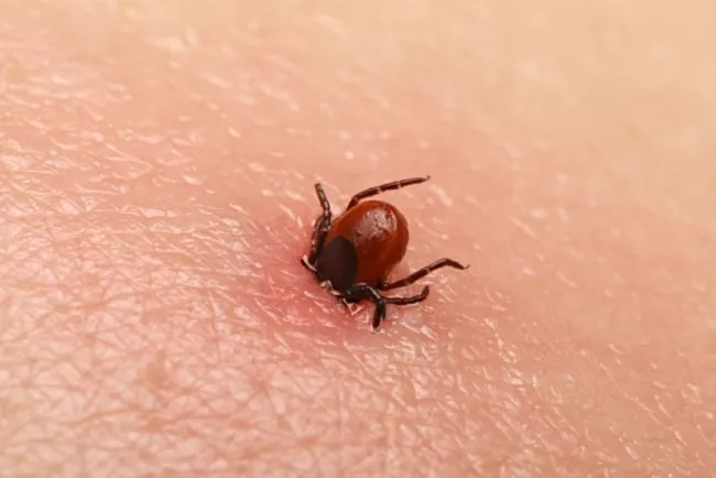 Fallece niño por rickettsia, Salud confirma el caso