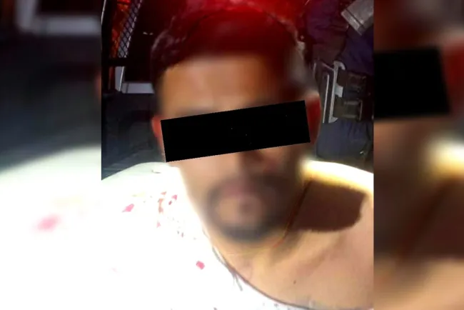 Quebra puerta de cristal y agrede con vidrio a oficiales