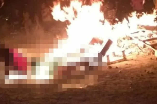 Con quemaduras de gravedad queda persona ebria