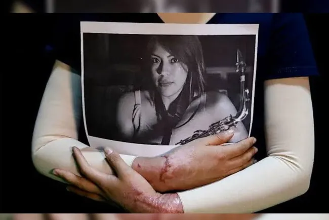 Publican “Ley Malena” contra ataques de ácidos o químicos