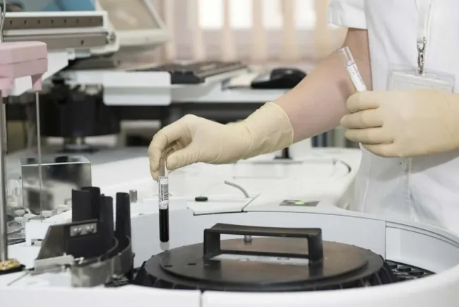 Mantienen alerta en Jalisco por brote infeccioso; suman 62 afectados