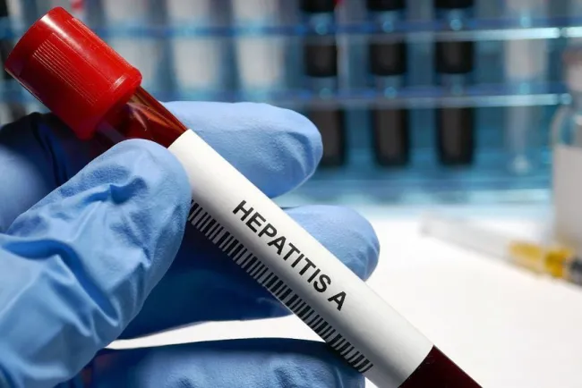 Aumenta hepatitis A en Estado de Arizona