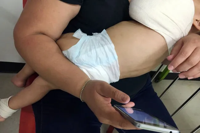 Presenta niño maltrato infantil