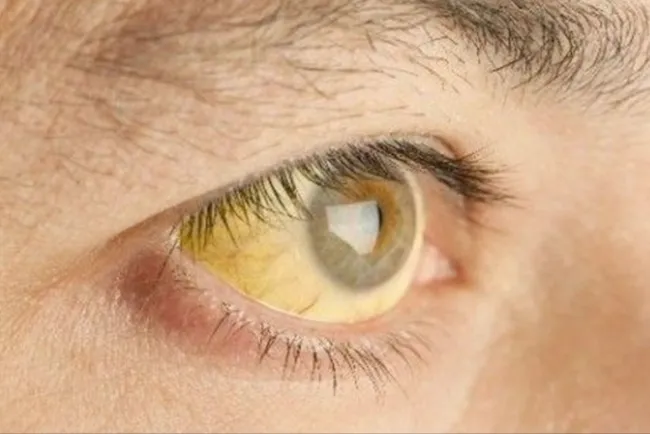 Llaman a evitar comer en la calle