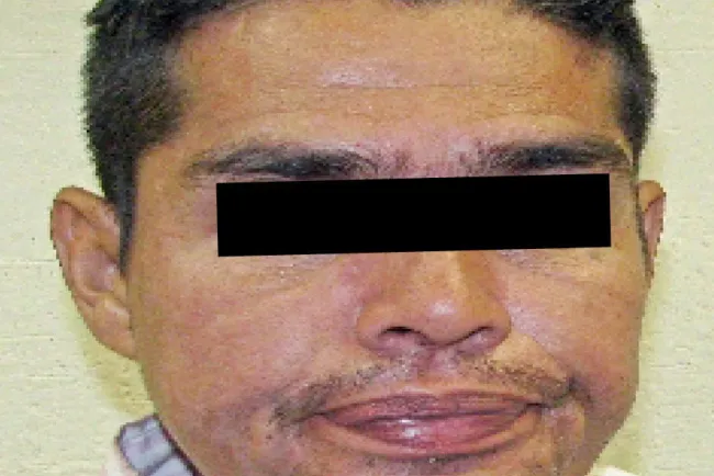 Sentencian a “El Educado” a diez años por asalto bancario