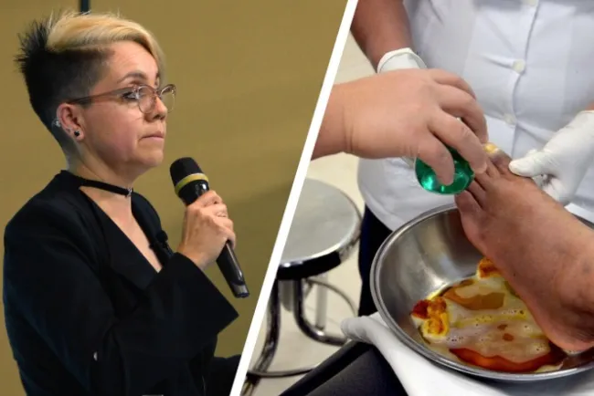 Crean en la UNAM parche que regenera piel de diabéticos en 21 días