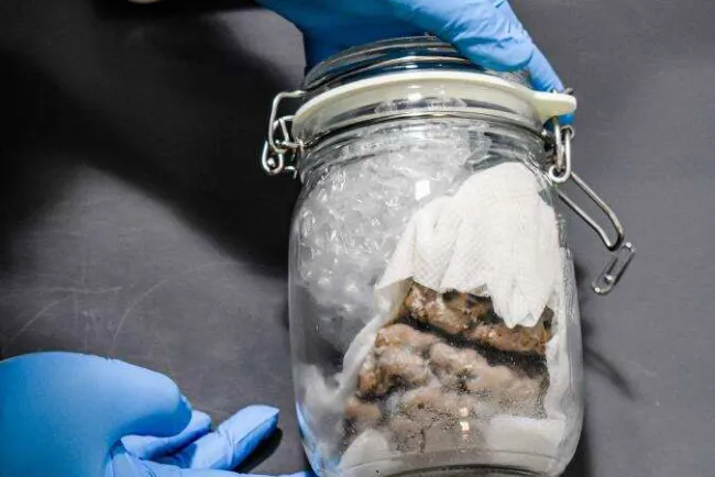 Decomisan cerebro enviado por correo