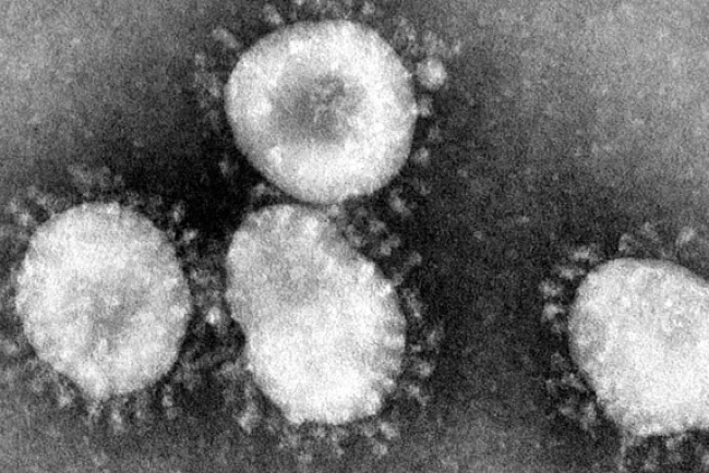 Alarma Coronavirus en Estados Unidos