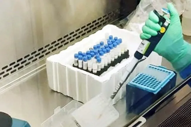 Denuncian que domina lentitud y opacidad en pruebas de coronavirus