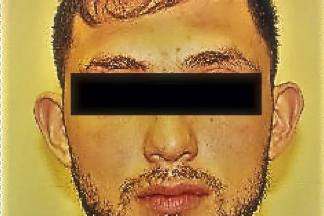 Vinculado al Delito de Sedición