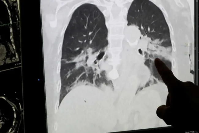 El coronavirus nos acompañará durante mucho tiempo: OMS