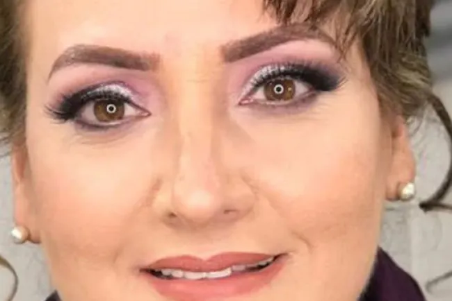 Retomará actividades Clínica de Equinoterapia