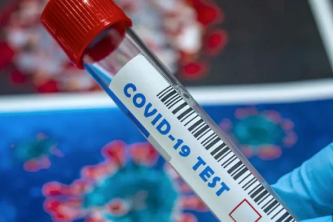 Sigue cobrando víctimas Coronavirus en Arizona