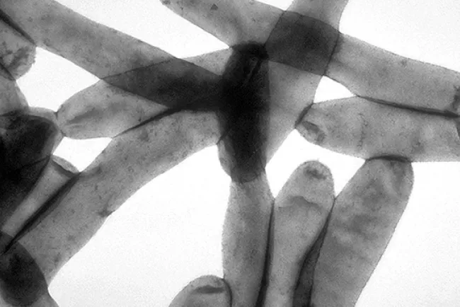 Localizan bacteria en edificios abandonados