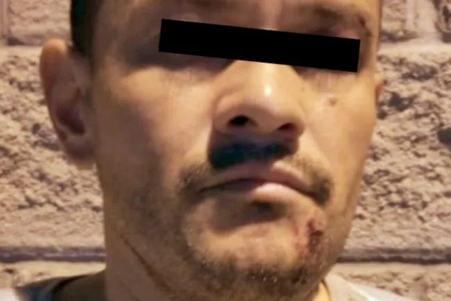 Prisión preventiva por lesiones con arma blanca