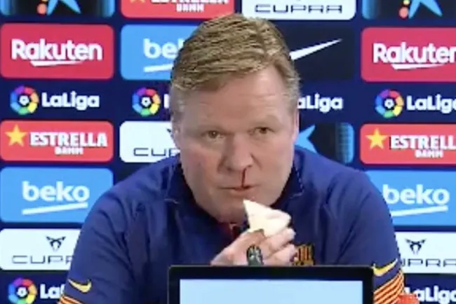 Koeman sangró por la nariz en la conferencia