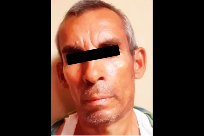 Quema a pareja mientras dormía