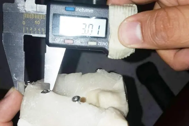Desarrolla IPN prótesis a base de polimeros para cadera