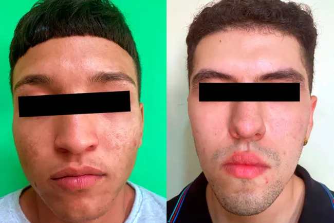 Rescata AMIC a joven “levantado”