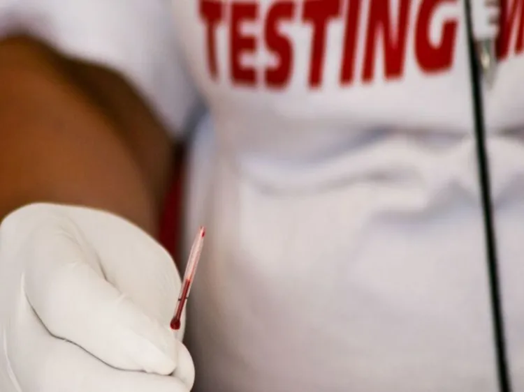 A casi 40 años de la pandemia del SIDA ¿por qué todavía no hay vacuna?