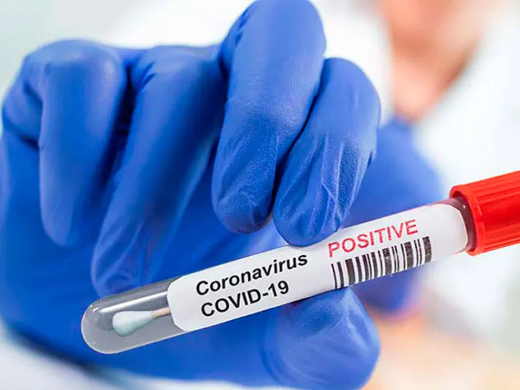 Registra Sonora 58 casos y una defunción por Covid-19