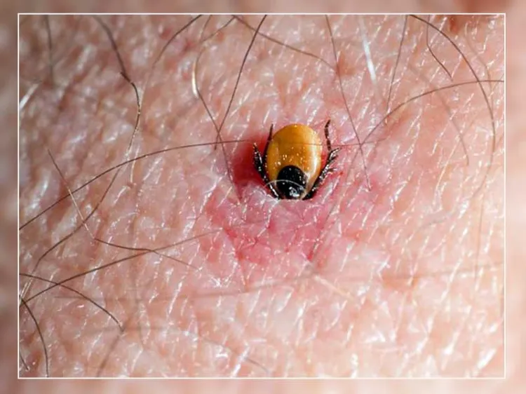 Alertan sobre presencia de garrapatas en patios