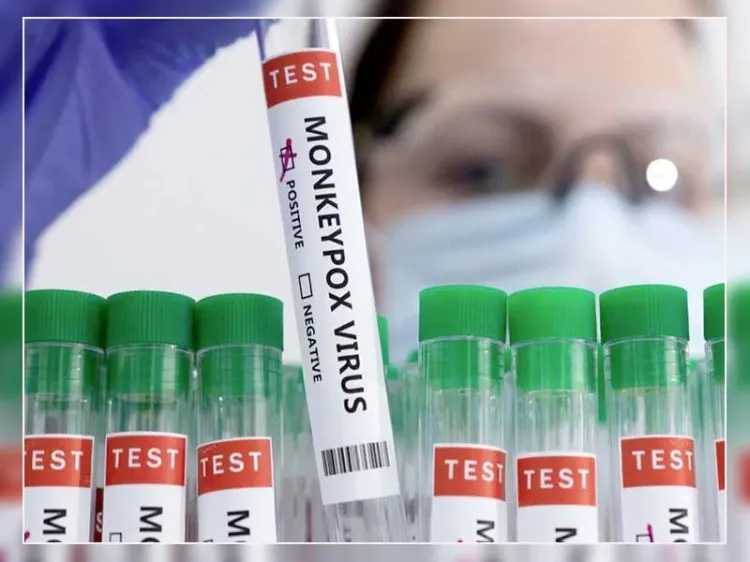 Estudian modos de transmisión de viruela símica