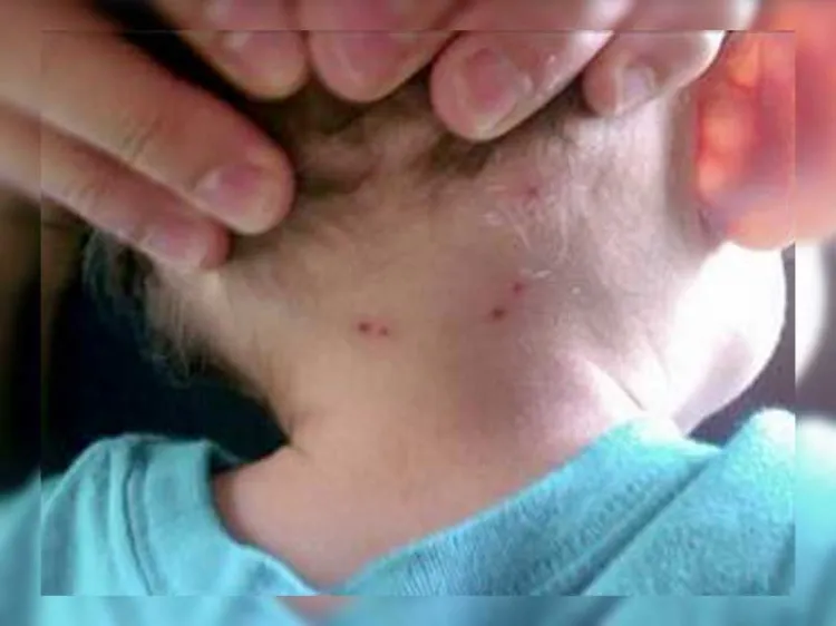 Alertan por casos de Rickettsia en esta frontera