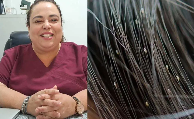 Explica experta como prevenir los piojos en verano y en invierno