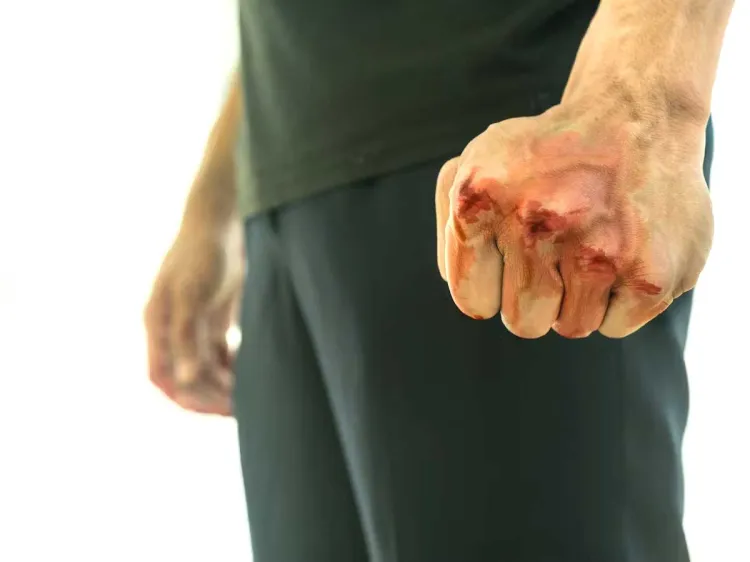 Ofrece la Unavim apoyo psicológico a personas violentas