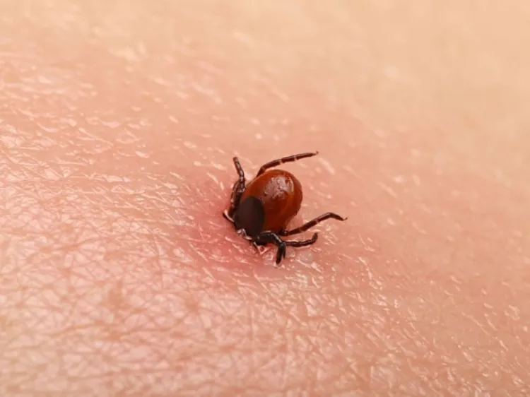 Fallece niño por rickettsia, Salud confirma el caso