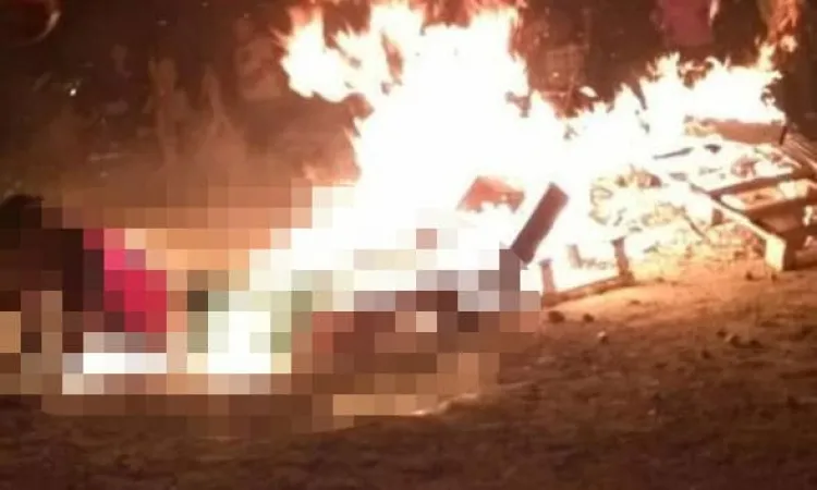 Con quemaduras de gravedad queda persona ebria